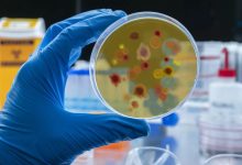 革命性检测技术!科学家开发出首个体内微塑料追踪方案 准确率达95% - 大风热搜网