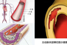 初春忽冷忽热，除了心梗脑梗，这种“隐形杀手”更凶险！ - 大风热搜网