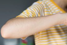 这些很多人认为的身体缺陷，其实是健康表现 - 大风热搜网