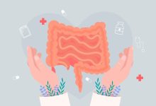 还在以为切除就万事大吉？肠息肉复发率高达60%，这份“防癌指南”请收好 - 大风热搜网